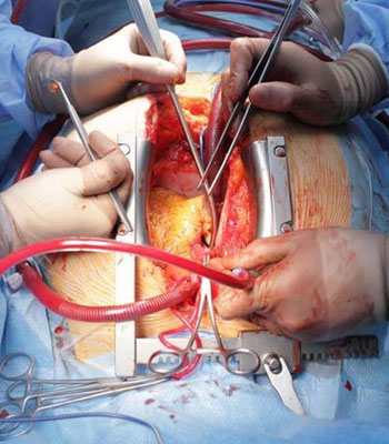 Cardiothoracic Surgery in Narasaraopet