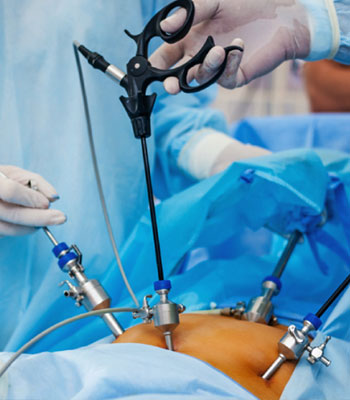 general laparoscopic surgery in Narasaraopet